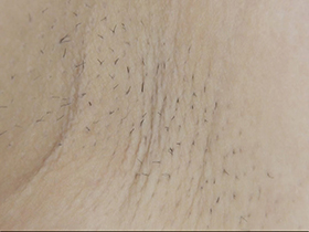 300人の腋 2　サンプル画像03